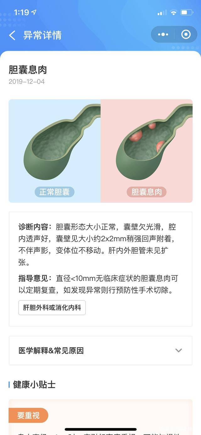 怎么投诉买了百万医疗保险之后众惠财产相互保险社拒绝理赔？